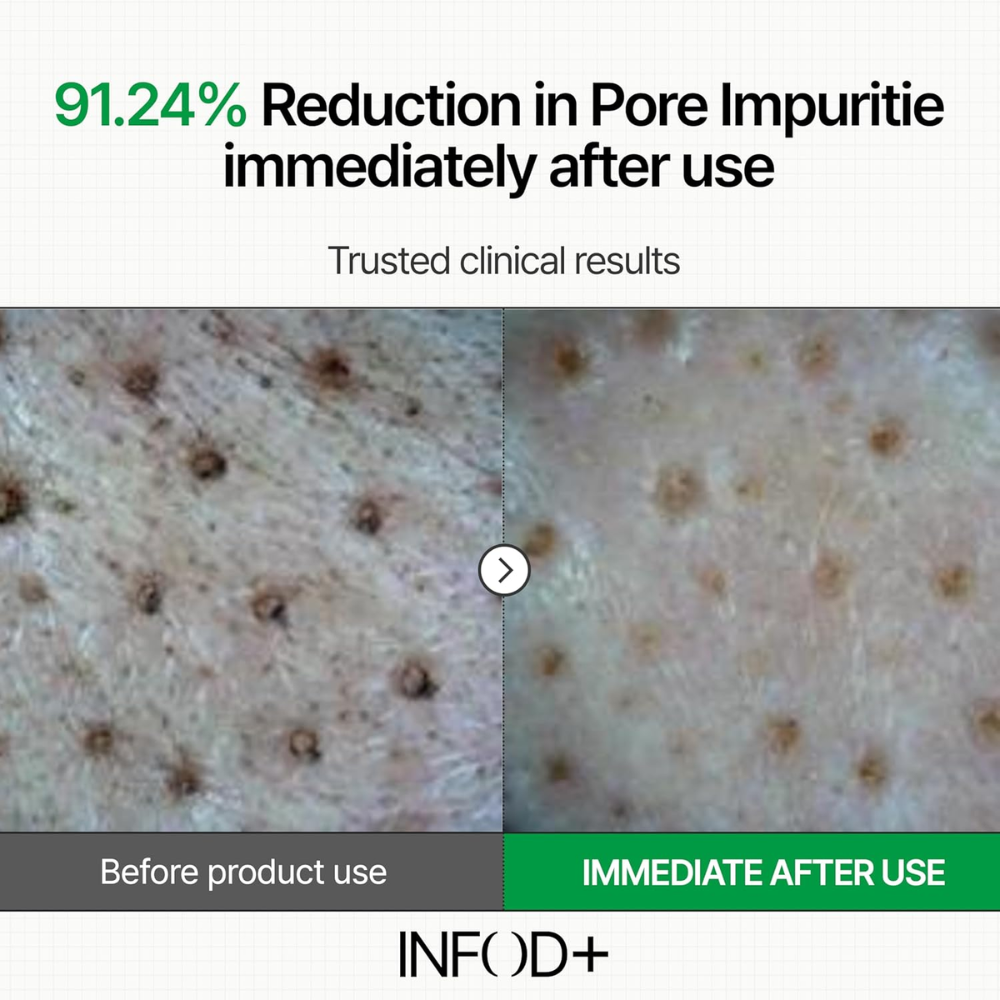 INFOD+ XCESPI316™ Gel Cleanser 100ml