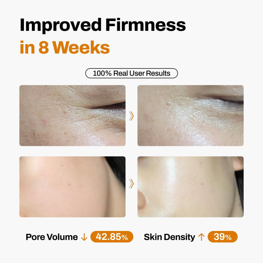 Jeu'Demeure DermiShuttle Lifting Kit – 8 Week Supply